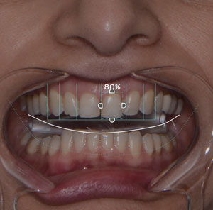Digital Smile Design
